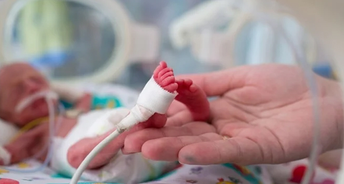 Лекари поставиха стент на бебе на 32 дни с вродена сърдечна малформация