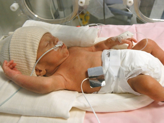 Нова здравна наредба: Бебе под 800 грама е биологичен отпадък