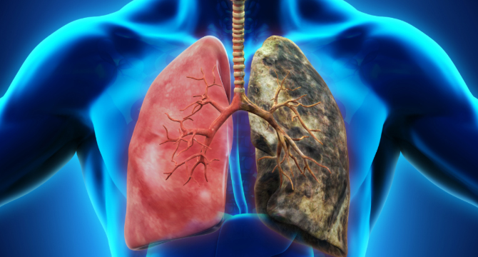 Медици дискутират новости в лечението на ХОББ, астма и белодробен карцином