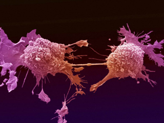 Тумори агенти убиват рака