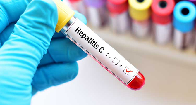 ВМА с нова апаратура за диагностика на хепатит С