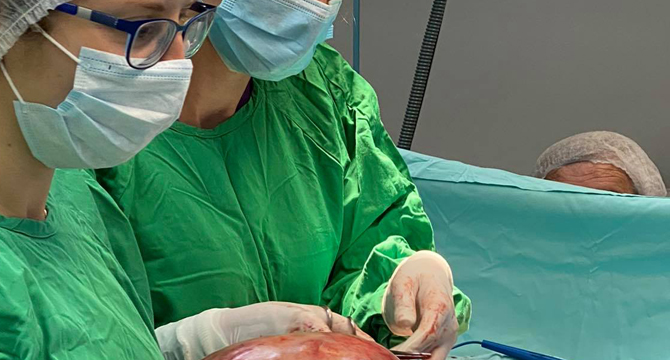 Лекари извадиха 12-килограмов тумор от пациентка