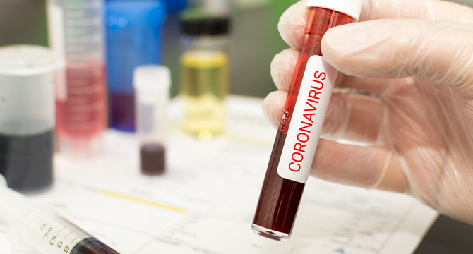 Кога се появяват първите симптоми ако сме заразени с коронавирус?