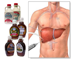 Оригиналният канадски кленов сироп и ползите му за здравето на черния дроб 