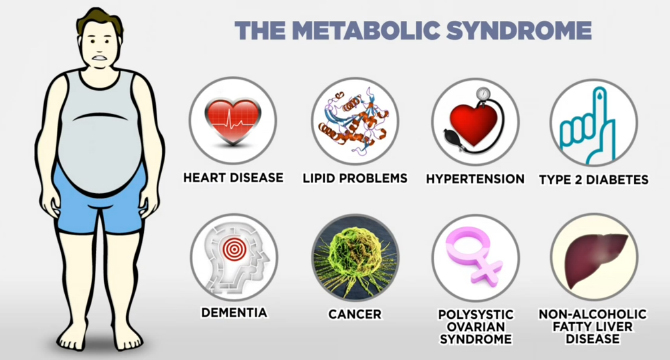 Какво представлява метаболитният синдром?