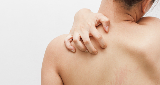 Обриви по тялото: Как да се справим с тях?