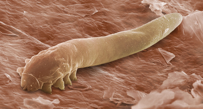 Какво са паразитите и как влияят върху нашето здраве?