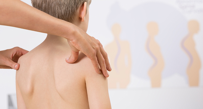 Близо 5 хил. деца от Русе са били изследвани за гръбначни изкривявания 