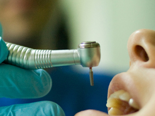 Крие ли опасности умъртвяването на зъб с арсен?