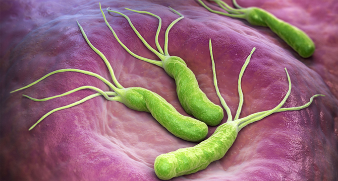 Хлебната сода не помага при хеликобактер пилори, може да се атакува с билки